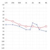 フォナック　ヴィータスプラス（耳あな式）をご納品しました