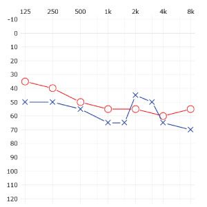 フォナック　ヴィータスプラス（耳あな式）をご納品しました